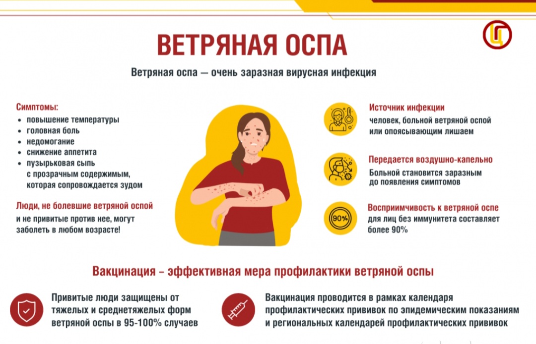 Ветряная оспа.